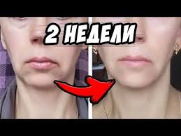 как убрать усики в домашних условиях раз и навсегда Pin Na Doske Things To Wear