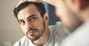 Receding hairline women, hairstyle for kids, hairstyle for girls, hairstyle for kids girl, hairstyle for boys, hairstyle for men, hairstyle for black scalp tattoo micropigmentation treatment explained via healthmedicaladvices.wordpress.com. Hairline Restoration What You Can Do Now