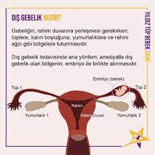 tup bebek tedavisi panosundaki pin