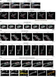 Check spelling or type a new query. Opa1 And Micos Regulate Mitochondrial Crista Dynamics And Formation Cell Death Disease