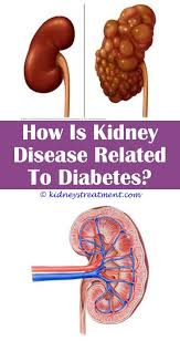 Kidney Disease Medical Kidney Disease Chronic Kidney Disease Kidney Infection