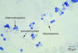 Fungal Infections Of The Reproductive System Microbiology