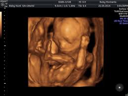 15 Mins Mini Wellbeing Scan - Baby Moments 3D 4D ultrasound Scan Centre  Oxfordshire