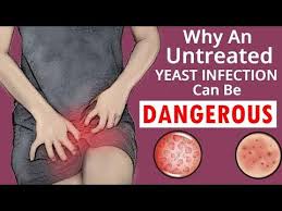 What Happens If A Yeast Infection Goes Untreated Find Out The Truth Youtube In 2020 Yeast Infection Yeast Infection Pictures Yeast Infection Essential Oils