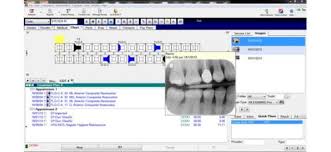 competent dental chart simple tooth chart health tooth organ