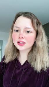 Moniscars Rosadita 3