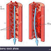 혈전 장애) 또는 2회 이상의 심부정맥 혈전증 에피소드가 있는 경우 와파린을. Https Encrypted Tbn0 Gstatic Com Images Q Tbn And9gcrkb9ke4vvrnb3nsqknh3lpasorhe24bhcl7sarehkyjiexiy16 Usqp Cau