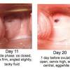 Aug 22, 2018 · during active labor, the cervix will dilate until it reaches 10 cm. 1