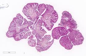 Image result for Centrostigma papillosum