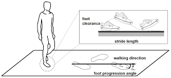 Image result for Foot Progression Angle