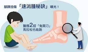 腳踝扭傷「速消腫秘訣」曝光！醫授2招「免開刀」：馬拉松也能跑– 台灣復健醫學會