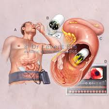 Image result for Virtual Endoscopy