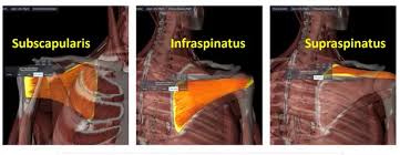 Image result for Rotator Cuff Rupture
