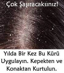 kepek kepek tedavisi kepek nasil gecer kepekten kurtulma kepek icin cozum sactaki kepek nasil gider kepek sac bi tki