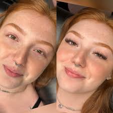 I loveee cosmetic acupuncture! It gives me an immediate glow and stops any  acne break outs I have in their tracks!