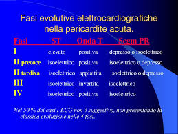 Modificazioni sequenziali (4 stadi) della ripolarizzazione ventricolare che riflettono la sofferenza degli strati subepicardici del miocardio. Ppt Fisiopatologia Del Pericardio Powerpoint Presentation Free Download Id 5792015