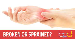 Most often, a sprained wrist takes place because of a fall or sudden twisting motion of the wrist. Broken Or Sprained Wrist Brandon P Donnelly Md