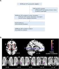 Image result for Thalamotomy