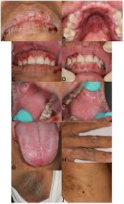 Image result for Oncinotis