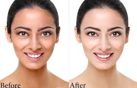 Black And White Bleaching Cream Side Effects Pin On Lightening Creams