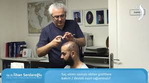 Sac Ekimi Sonrasi Ekilen Greftlere Bakim Destek Nasil Saglanmali Youtube