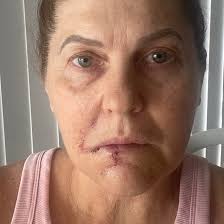 Australia's Biggest Morning Tea