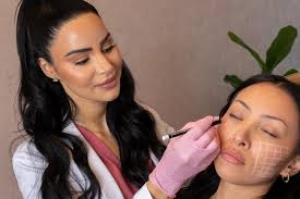 The Ultimate Guide to PDO Thread Lift