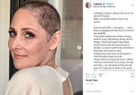 Témoignages de patients découvrez les résultats illustrés des membres du forum sujets : In 2013 I Predicted A Hair Loss Cure In 2020 Hair Loss Cure 2020