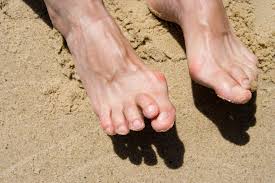 Image result for Hammer toe
