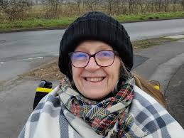 Fundraiser by John Harrhy : Cranioplasty (Titanium Plate) for Keri