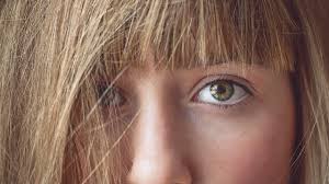 Bei vielen vorher nachher vergleichen einer haartransplantation kann man auf den ersten blick nicht einmal sicher sagen, ob es sich tatsächlich auf beiden bildern um dieselbe person handelt. Rizinusol Gut Fur Haare Und Wimpern Utopia De