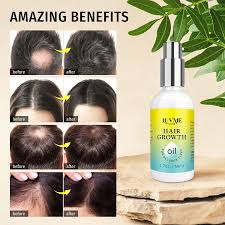But as to whether it prevents hair loss or even provides any real health benefits, studies and expert. Buy Luv Me Care Hair Growth Oil With Caffeine And Biotin 2 Pack Biotin Hair Growth Serum For Stronger Thicker Longer Hair 1 7 Oz Online In Vietnam B092xy9zts