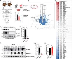If a cell did not have lysosomes, it would potentially starve, since lysososmes contain enzymes important for digesting nutrients. The Lysosomal Transporter Mfsd1 Is Essential For Liver Homeostasis And Critically Depends On Its Accessory Subunit Glmp Elife
