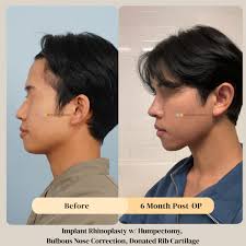 345 Bone Specialist Park Jong LIm Park Jong-lim, a facial contour master  whose major is craniofacial biology. He is the representative doctor who is  in charge of management from start to finish