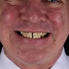 TOP 10 BEST Prosthodontists in Reno, NV