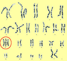 Chromosomenmutationen Lecturio Medizin Magazin