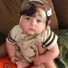 Fundraiser by Jaime Hartrum : Helmet & Hospital Stay For Alex