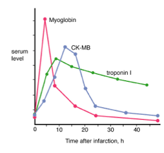 Cardiac Enzymes Serum Level And Time After Infarction