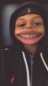 Ig Filter Smiling With Braces Light Skin Boys Boys With Green Eyes Light Skin