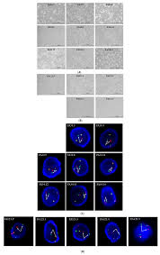 Everything you don't want to happen will happen, and you might find yourself begging for privacy and alone time. Cancers Free Full Text Transfer Of Extracellular Vesicle Associated Rnas Induces Drug Resistance In Alk Translocated Lung Adenocarcinoma Html