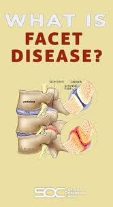 Pin On Back Pain