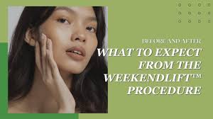 WeekendLIFT™ Insights: Recovery, Benefits & What to Expect