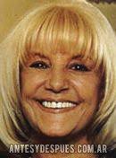 El Antes y Despues de Beatriz Taibo