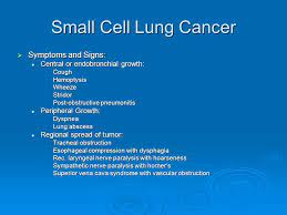 Small cell lung cancer is a disease in which malignant (cancer) cells form in the tissues of the lung. Heme Onc Presentation Ppt Video Online Download