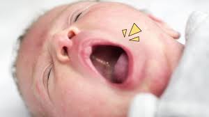 Kebersihan mulut bayi yang kurang terjaga. Epstein Pearls Pada Gusi Bayi Berbahayakah Orami