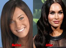 See megan fox's transformation right before your eyes. Megan Fox Plastic Surgery Before And After Photos Famewatcher