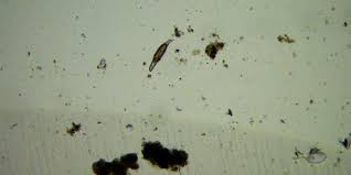We did not find results for: Wet Mounts And Pond Critters Kv5r Com