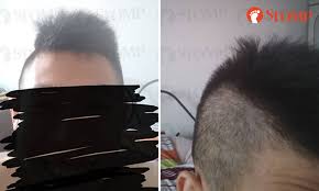 Straight hairstyles that can attract people? Guy Ends Up With Uneven Hair After Visiting Woodlands Salon Told It Will Grow Back