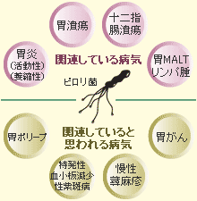 「ピロリ菌」の画像検索結果