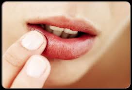 Sometimes the herpes simplex virus can spread to one or both eyes. Cold Sores China Pdf Ppt Case Reports Symptoms Treatment